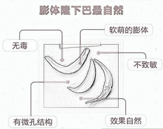 科普|假体隆下巴哪种材质果较好？怎么样？