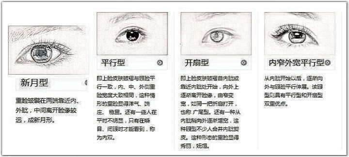 双眼皮手术方式大解析