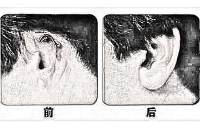 浙江耳部整形 浙江绿城医院整形科耳部再造的价格贵不贵