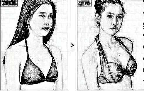 上海华美李健、谢卫国做隆胸哪个好？多少钱？