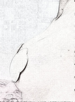 丰胸,现在不管穿什么样的衣服都有样子了。