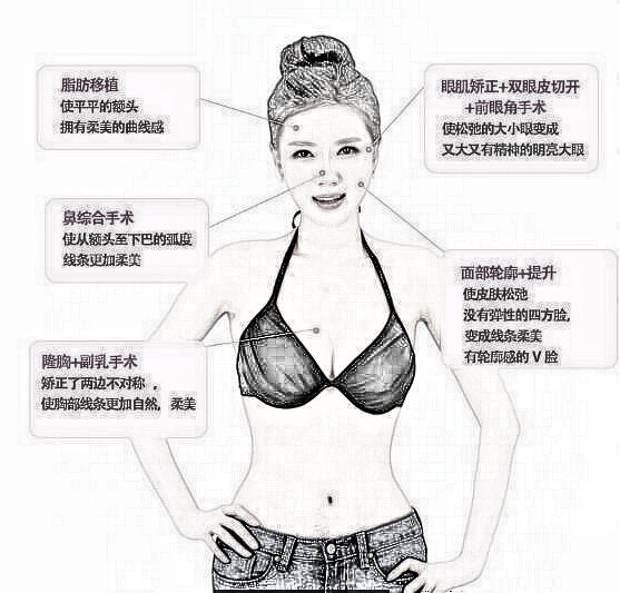 全脸改造+隆胸是什么样的？