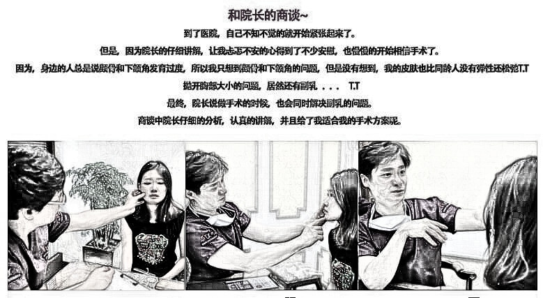 全脸改造+隆胸是什么样的？