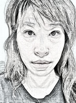 看起来显老怎么办?磨颧骨、去眼袋、做填充
