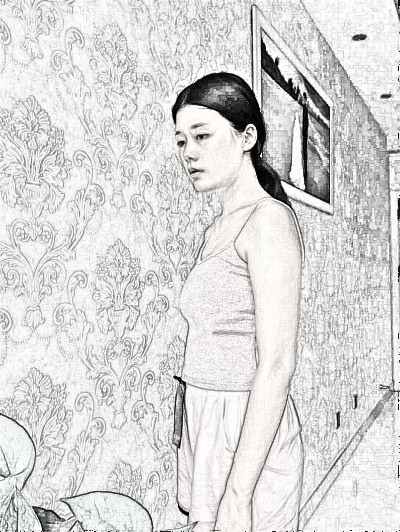 南京艺星医疗美容隆胸怎么样？朱刚强医生自体脂肪隆胸介绍分享