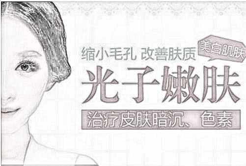 只做一次光子嫩肤的果能维持多久？