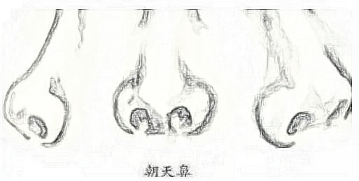 鼻孔外露手捏就能解决？还是手术比较靠谱！