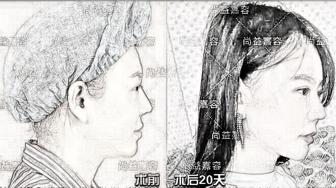 爱多邦黎星院长面部加减介绍——“驻颜术”越活越年轻的秘密~