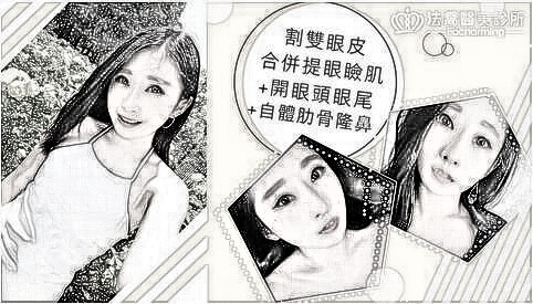 邱浚彦开眼尾+割双眼皮+隆鼻介绍，这位美铝涅槃重生？！