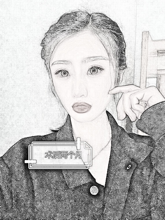 双眼皮手术近视也可以做吗？