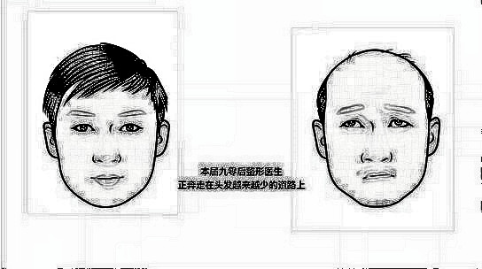 整形医生男友的求生欲——看看都有哪些沙雕的骚操作！