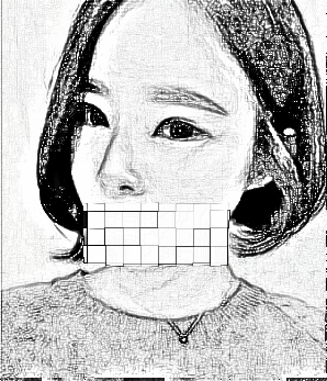 鼻头整形介绍:鼻头缩小让我有所改变