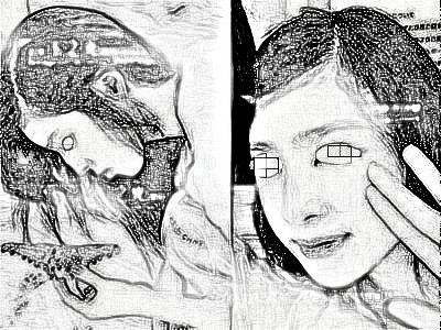 隆鼻介绍,变美正确的选择