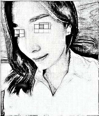 眼鼻介绍分享:没忍住终于还是去做了鼻子和眼睛