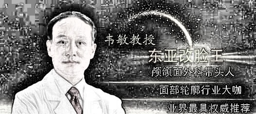 上海九院韦敏磨骨怎么样?术后经验分享