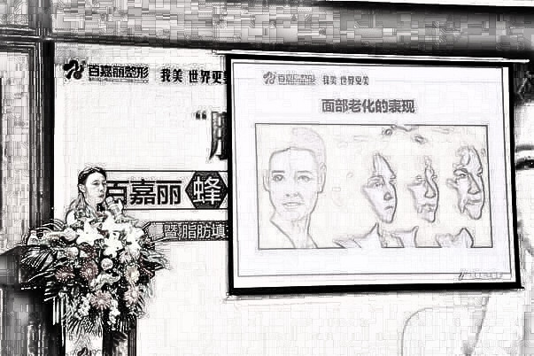 【百嘉丽新技术发布】“蜂巢”脂肪填充，引领脂肪填充新风尚！