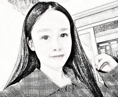 去九院做了眼袋去除手术~来看看果
