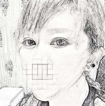 济南名流美容整形医院双眼皮怎么样？前后一览
