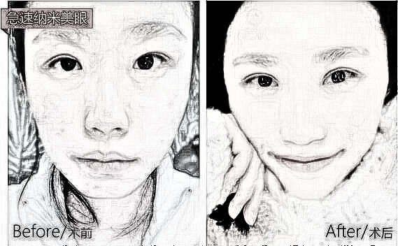双眼皮可以做一边吗，钱只交一半的那种？