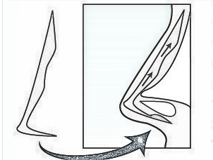 【介绍】隆鼻了!给大家分享一下体验