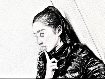 成都鼻部手术--打造精致小翘鼻