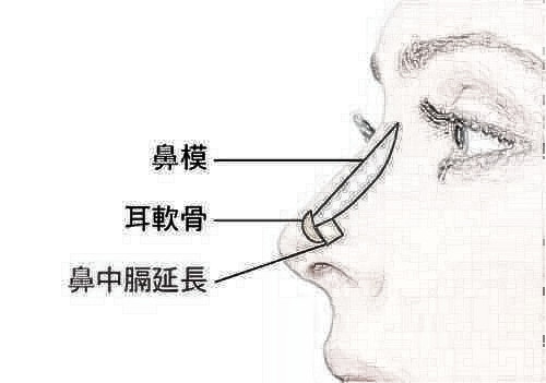 鼻部手术一般有多久的恢复期