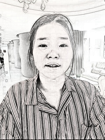 深圳微姿医美医生康壮为面部吸脂介绍分享