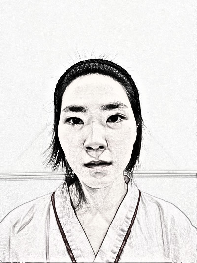 上海百d丽医美医生沈国雄肋软骨隆鼻介绍分享
