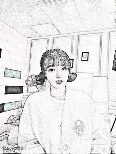 长沙妹纸在美莱医美隆鼻之后恢复感受分享