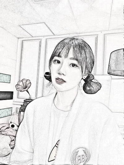 长沙妹纸在美莱医美隆鼻之后恢复感受分享