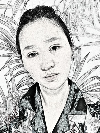 美女在杭州薇琳温科磊医生隆鼻果附图分享