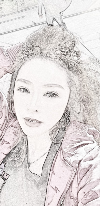 深圳爱美者格美医美黄印资医生埋线提升果分享