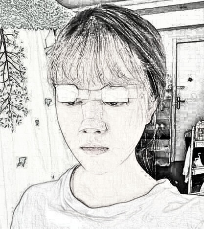 隆鼻双眼皮双管齐下，美得不像话!