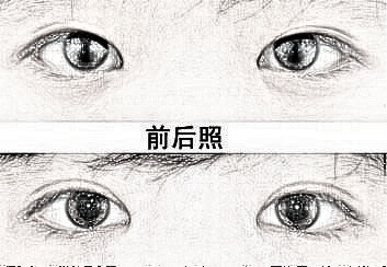 上海九院眼部手术做得好不好?