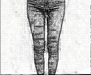 成都米兰孙林潮医师介绍分享 90天大腿吸脂前后