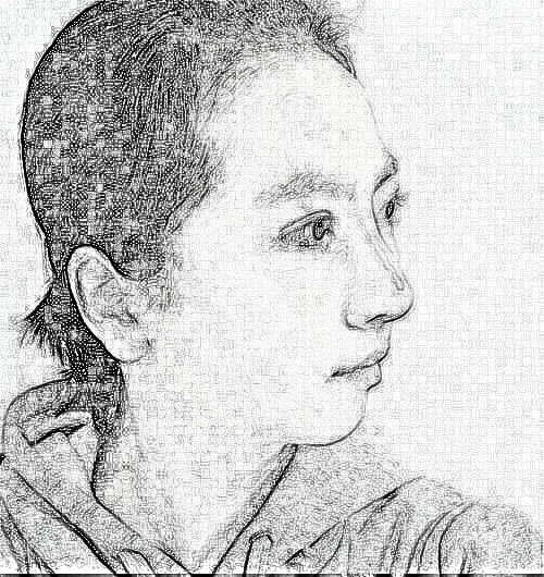 重庆美轮美奂肖倩介绍 隆鼻65天前后图分享