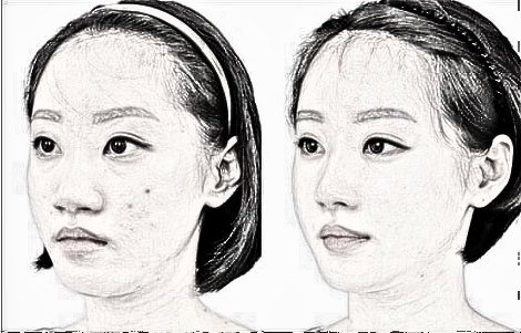 西安美立方整形医院怎么样?隆鼻怎么样??介绍