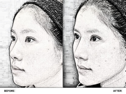 您必须知道的关于隆鼻的冷知识！