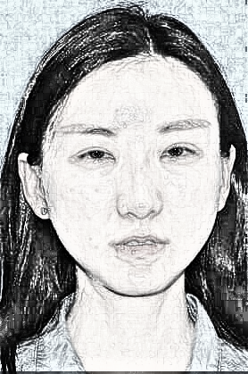 成都米兰整形医院隆鼻介绍分享