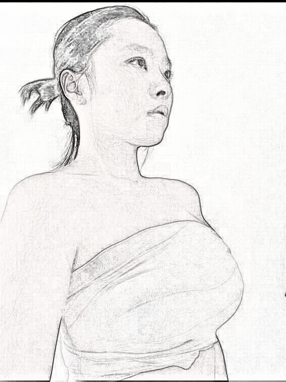 智美颜和隆胸怎么样?实际介绍分享