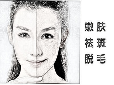 opt光子嫩肤有什么作用 果好吗