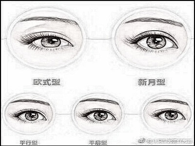 肿眼泡怎么做双眼皮手术