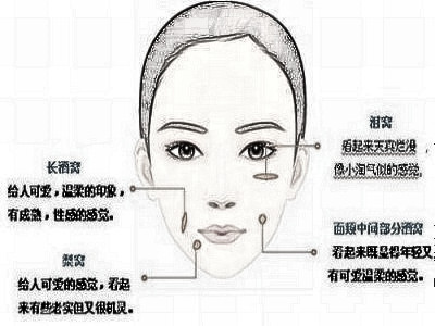 酒窝整形有哪些方式 风险高吗