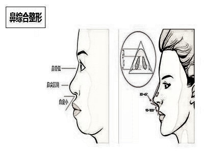 隆鼻整形和鼻部手术哪种好