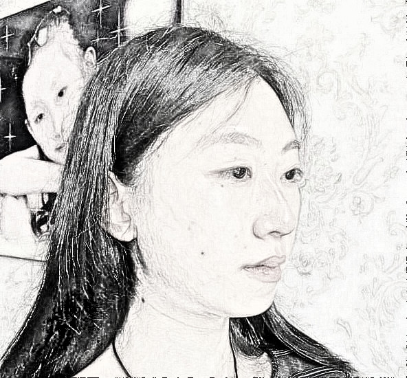 西安美立方李旭平医师隆鼻介绍 35天前后图分享