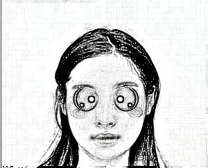 杭州东方姜颂期做鼻子怎么样?隆鼻介绍70天前后图分享
