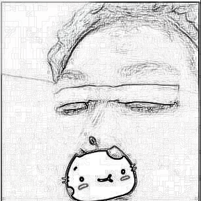 南京连天美厉立辉做的双眼皮 两个月的果真的很不赖