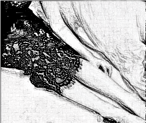 深圳富华万友望做大腿吸脂怎么样?60天前后果真的超乎想象