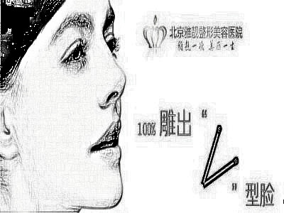 玻尿酸填充泪沟需要几只才行