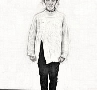 南京维多利亚刘光伟介绍 大腿吸脂60天前后图分享
